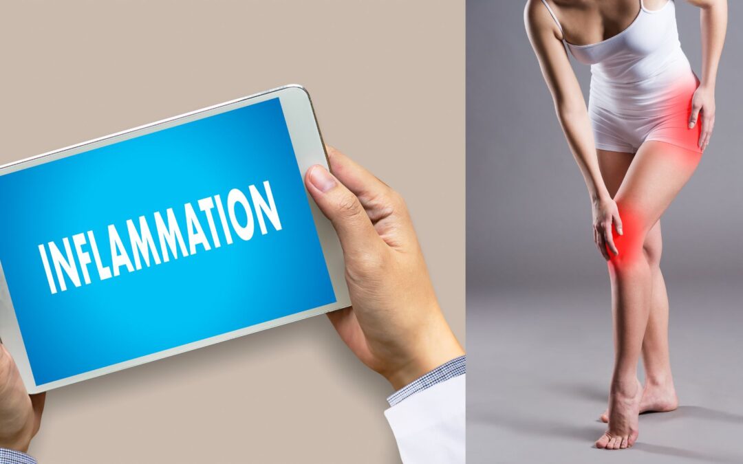 Inflammation – the good, the bad, the ugly, and how to avoid it